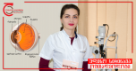 Возрастная дегенерация желтого пятна